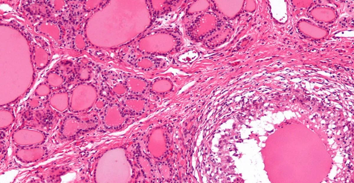 Closeup of pink colored cells under a microscope.